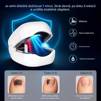 Coeurva Laserové LED zařízení pro léčbu nehtové mykózy
