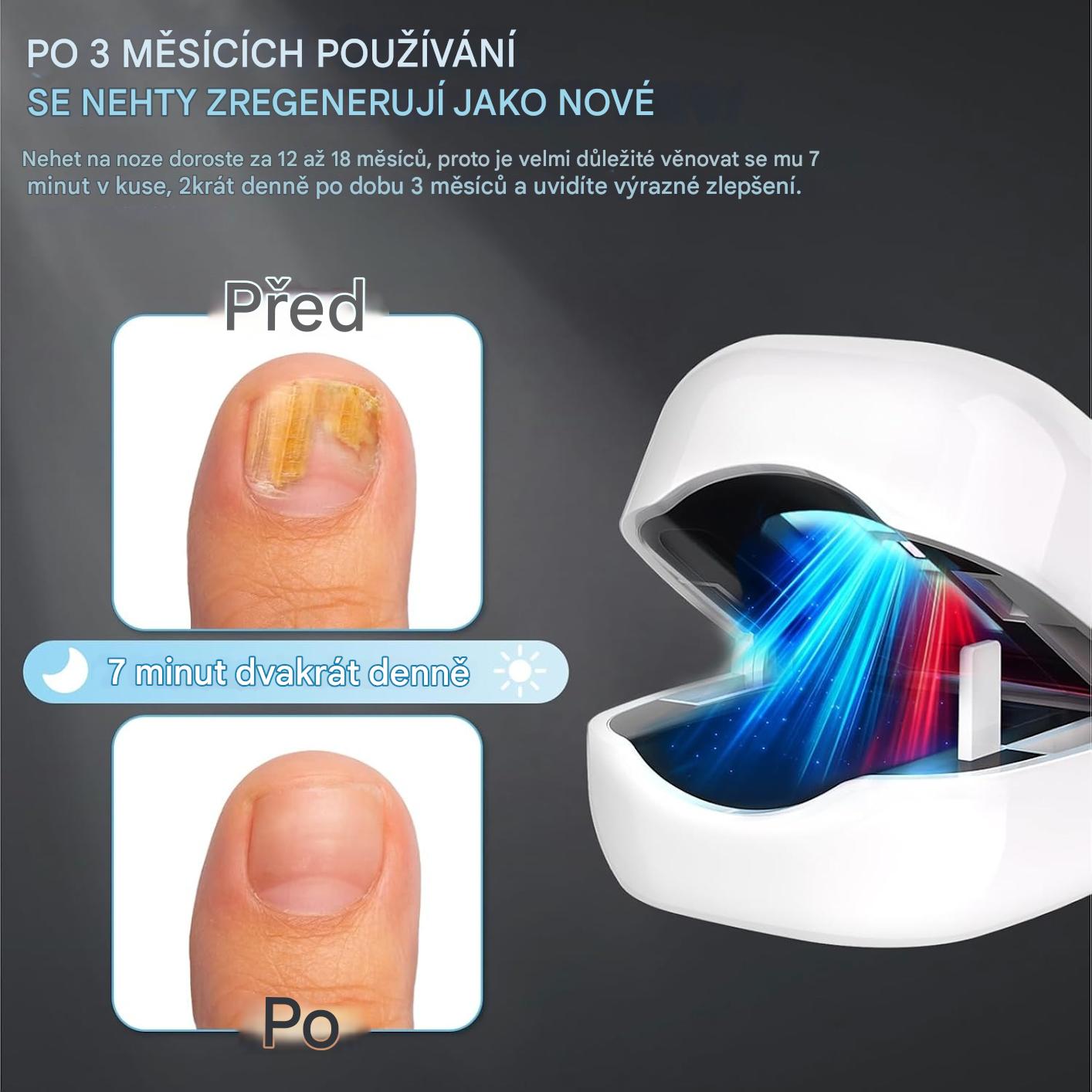 Coeurva Laserové LED zařízení pro léčbu nehtové mykózy