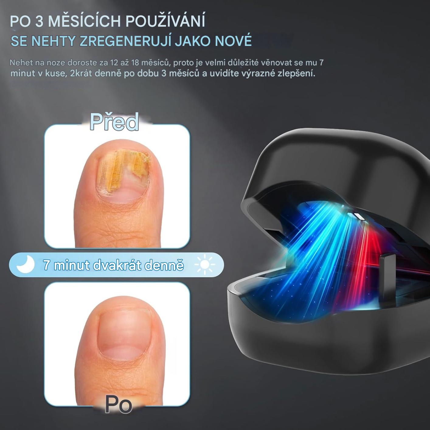 Coeurva Laserové LED zařízení pro léčbu nehtové mykózy